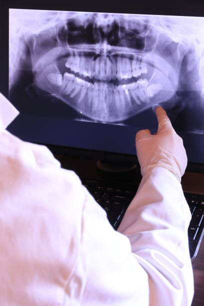 Best Emergency Tooth Extraction in Temperance, MI